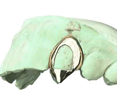 Custom] 10K Gold Open Face Fang Grillz Single – Rhino Grillz