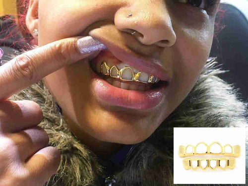 Gold Cap Teeth Open Face Grill Single Tooth Cap Custom Fit 14k