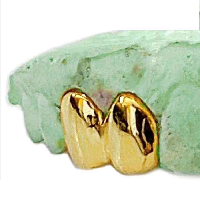 [Custom] 18K Gold Double Teeth Grillz