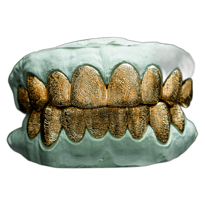 Gold teeth with hot sale diamond dust