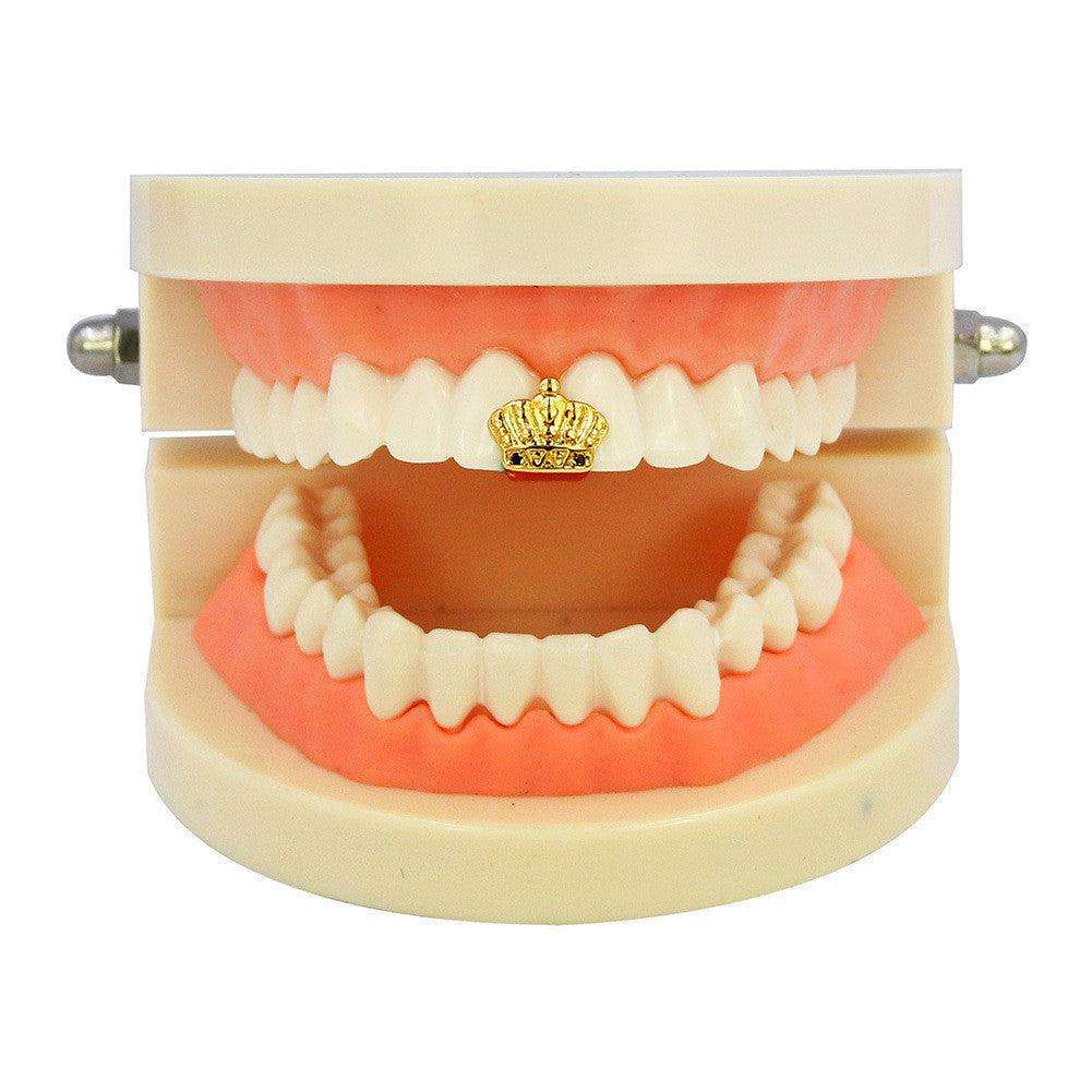 Crown Grillz – Rhino Grillz